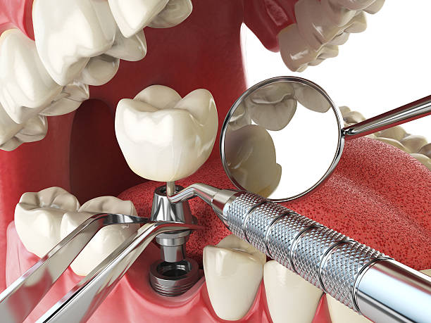 Professional Emergency Dental Service in SD